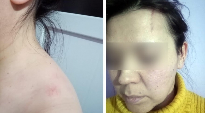 seren serengil in hizmetçisini darp etmesi