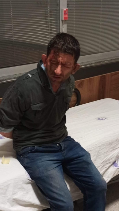 polise kürekle vuran piçin son hali