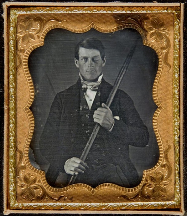 phineas gage vakası