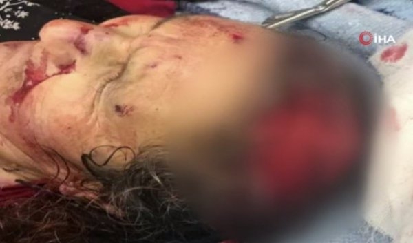 9 u birden saldırdı vücudumda kan bırakmamışlar