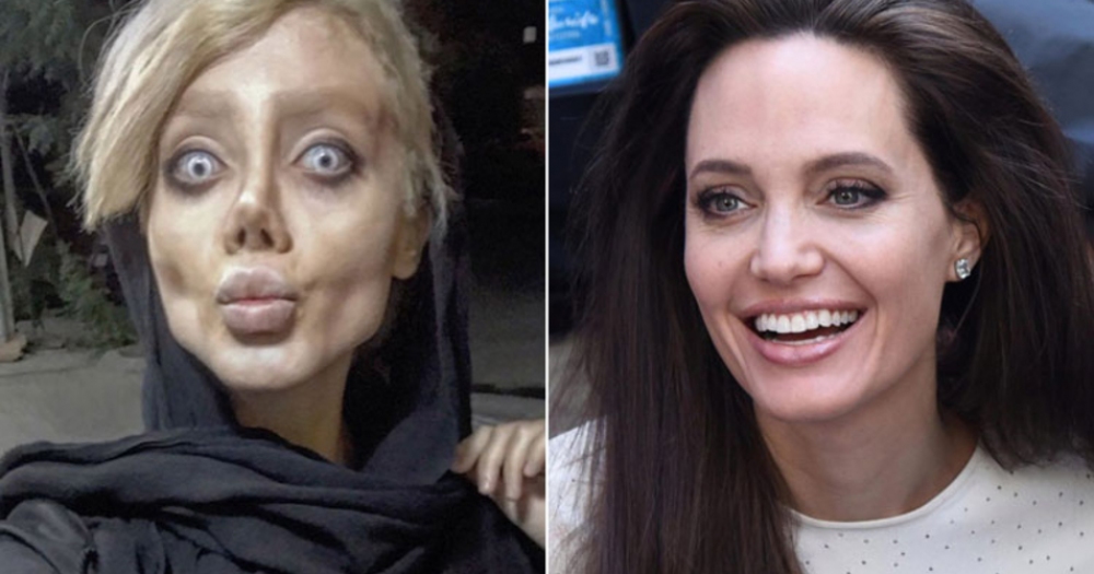 Angelina Jolie'ye Benzemek İsteyen İranlı Kadının Dramı