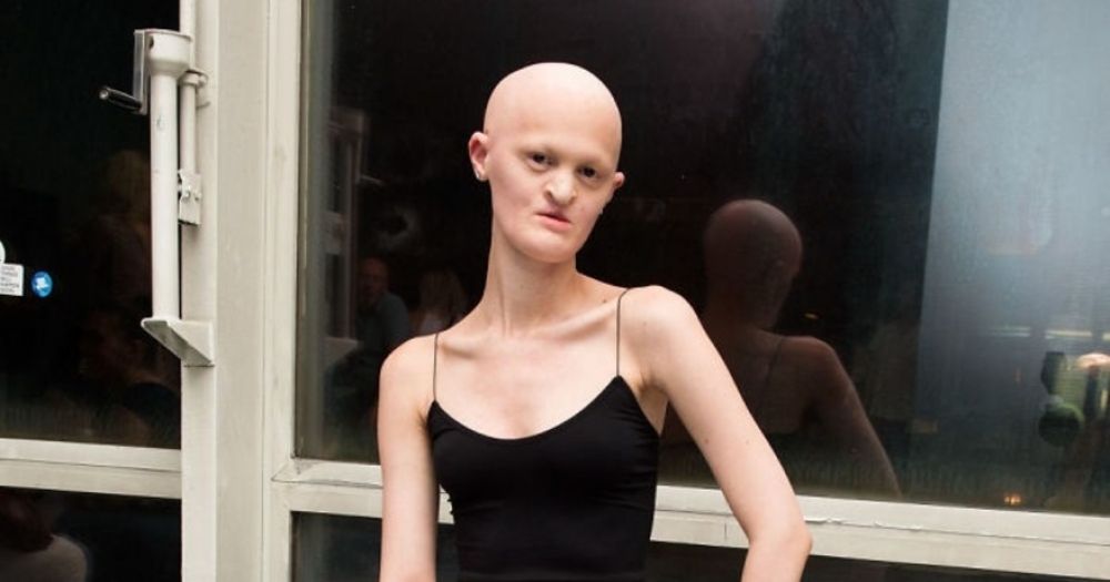 Zihninizdeki Manken İmajını Sonuna Kadar Değiştirecek Modelin 18 Hayret Verici Fotoğrafı