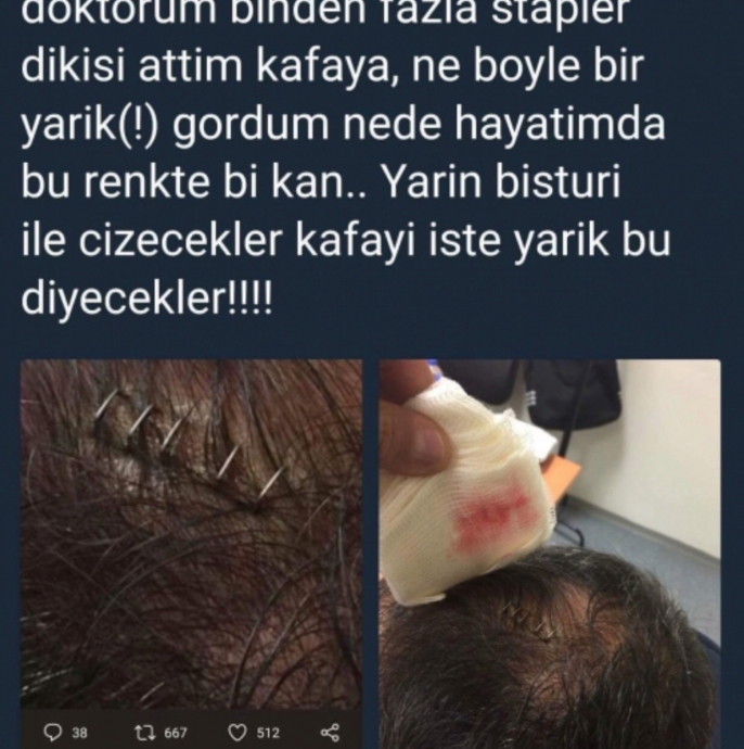 şenol güneş in kanının pembe olması