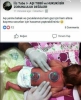 aşı yerine çocuklarınıza hacamat yaptırın / #1602991