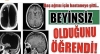 beynimin olmayışının varoluşsal hissi / #1783697