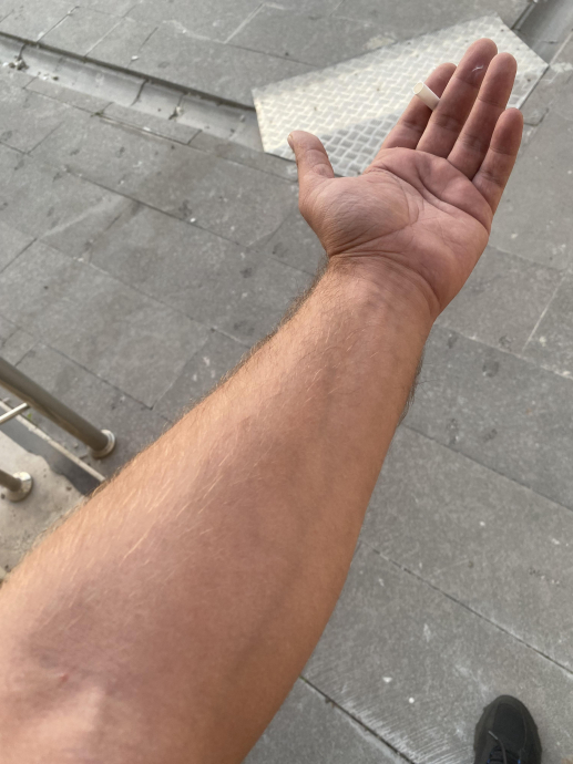 sözlük kızlarının bilekleri neden kalın sorunsalı