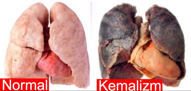 kemalizmin sağlığa zararları