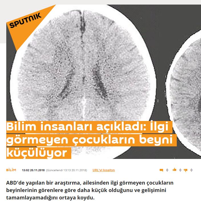 Bilim insanları açıkladı: İlgi görmeyen çocukların beyni küçülüyor Bilim insanları açıkladı: İlgi görmeyen çocukların beyni küçülüyor