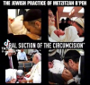 metzitzah b peh