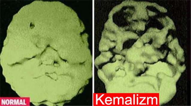 kemalizmin sağlığa zararları