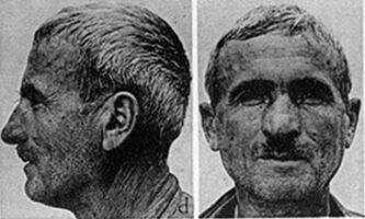 homo alpinus