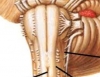 omurilik sarımsağı cevabını veren doktor / #2126442